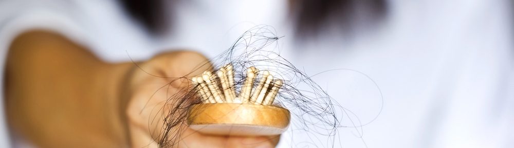 Common Causes of Female Hair Loss and the Solutions to it