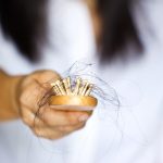 Common Causes of Female Hair Loss and the Solutions to it