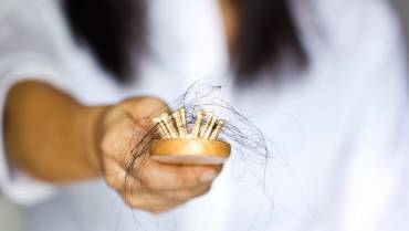 Common Causes of Female Hair Loss and the Solutions to it