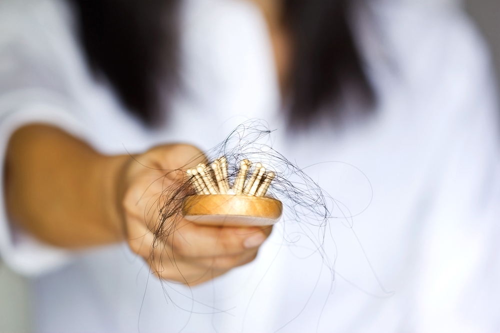 Common Causes of Female Hair Loss and the Solutions to it