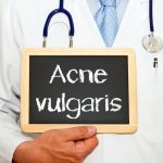 How to treat & manage acne vulgaris