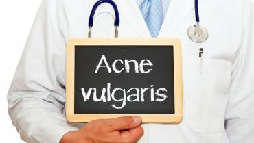 How to treat & manage acne vulgaris