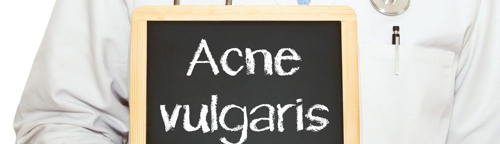 How to treat & manage acne vulgaris