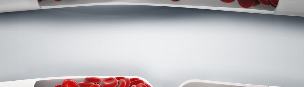 Anticoagulants medicines can be used to reduce blood clotting