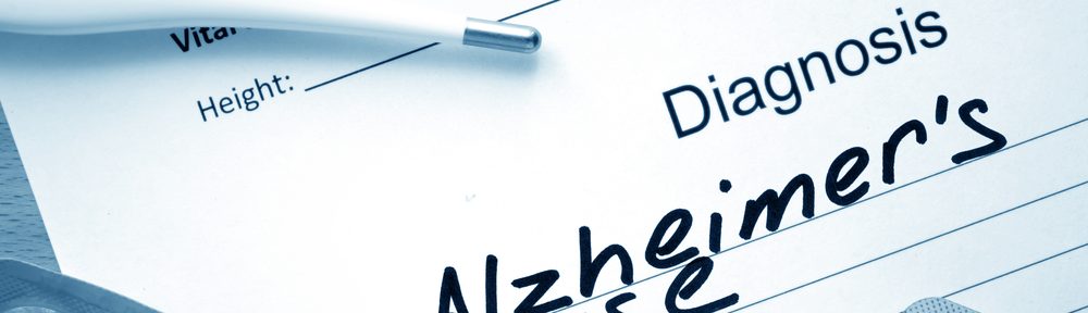 5 myths about Alzheimer Disease that you should be aware of