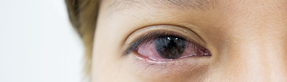 Eye Symptoms and What They Could Cause