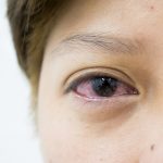 Eye Symptoms and What They Could Cause