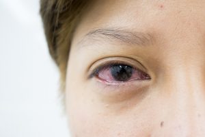 Eye Symptoms and What They Could Cause