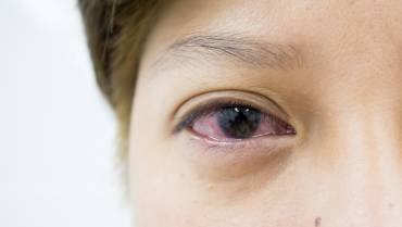 Eye Symptoms and What They Could Cause