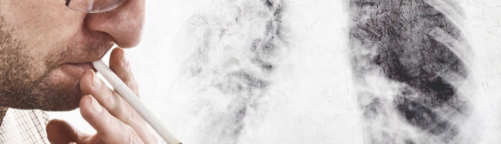 shutterstock_188415908