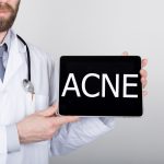 New Acne Treatments in Research