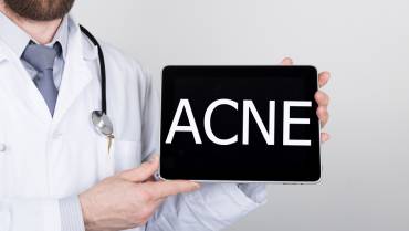 New Acne Treatments in Research