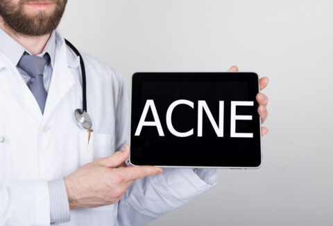 New Acne Treatments in Research