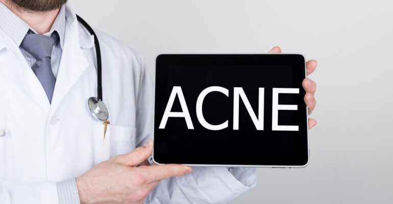 New Acne Treatments in Research