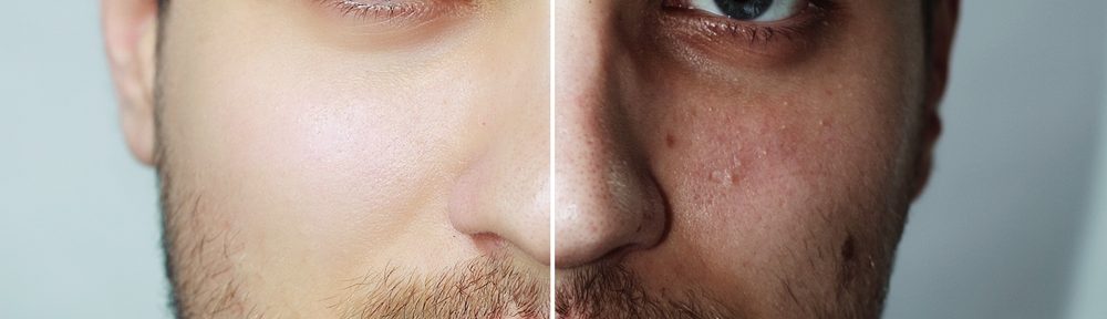A Conclusive Guide for Men to Look and Feel Younger