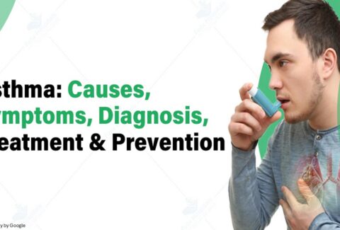 diagnose, and treat asthma cough - ADC