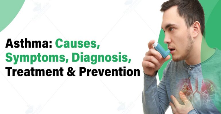 diagnose, and treat asthma cough - ADC