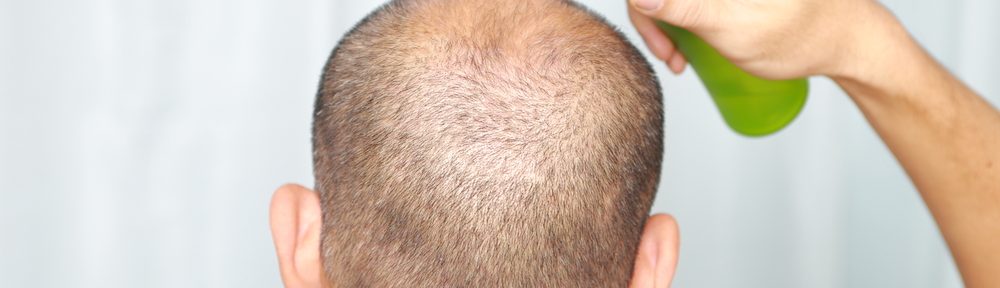 Promote Hair Growth and Prevent Hair Loss