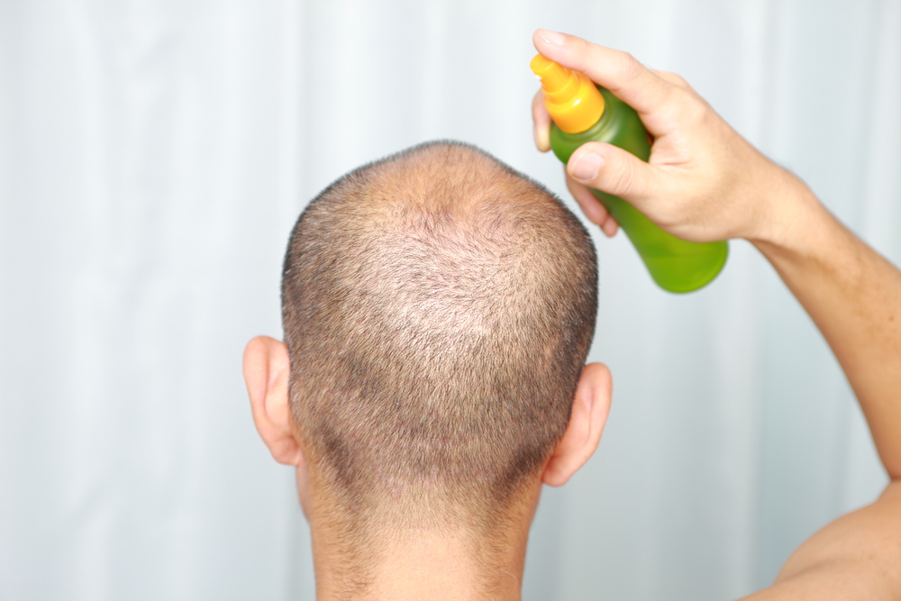 Promote Hair Growth and Prevent Hair Loss