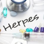Genital Herpes and HIV