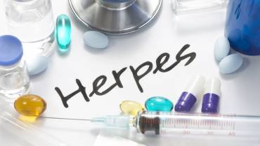 Genital Herpes and HIV