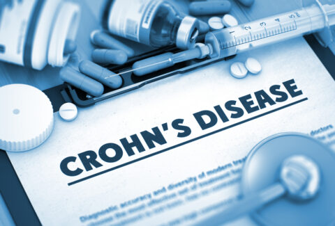 Questions to ask your nutritionist when diagnosed with Crohn's disease