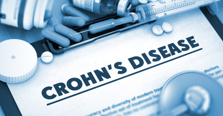 Questions to ask your nutritionist when diagnosed with Crohn's disease