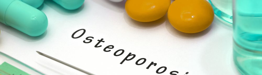 You are at Risk for Osteoporosis