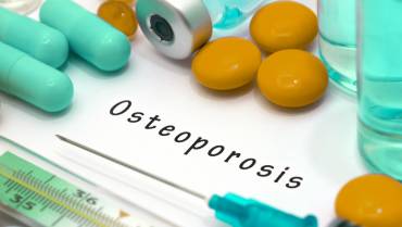 You are at Risk for Osteoporosis