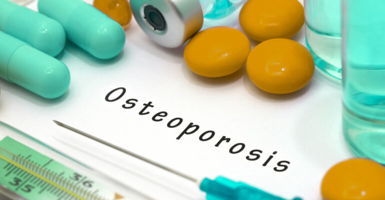 You are at Risk for Osteoporosis
