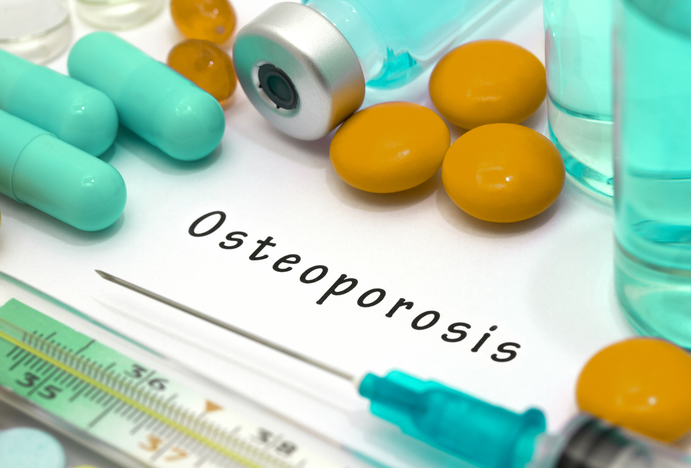 You are at Risk for Osteoporosis