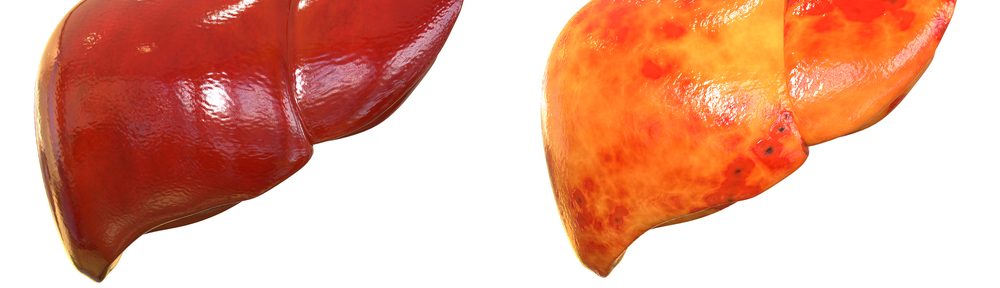 Know the Essential Facts about Your Liver