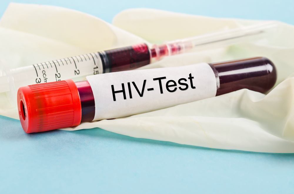 Genital Herpes and HIV
