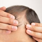Promote Hair Growth and Prevent Hair Loss
