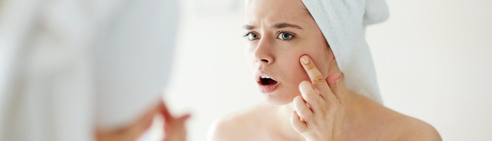 Top 5 Reasons Why Your Acne Keeps Coming Back!