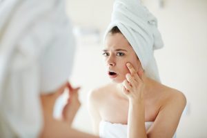 Top 5 Reasons Why Your Acne Keeps Coming Back!
