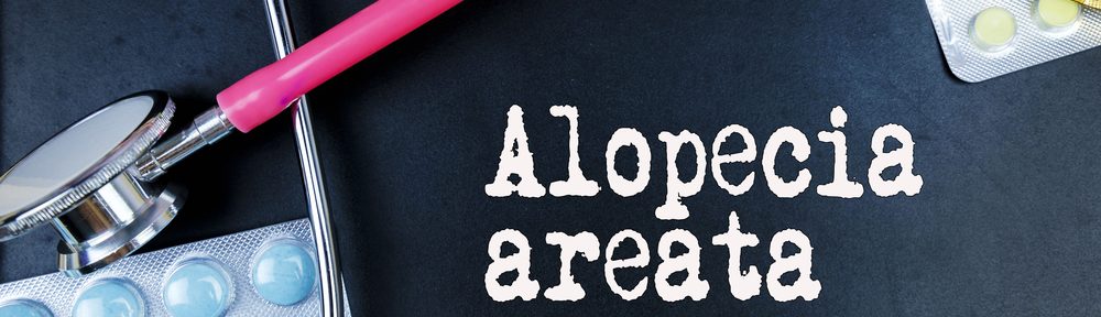 What is Alopecia Areata? Can this type of Hair Loss be treated?
