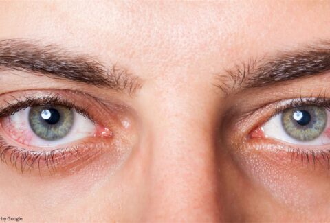 dry eye symptoms - All Day Chemist