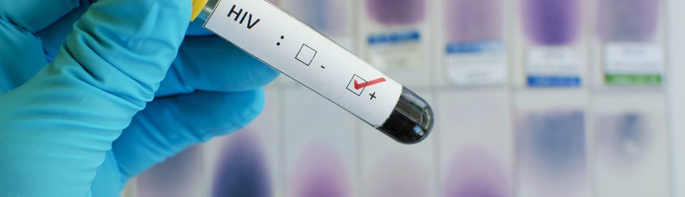 5 things you may not know about HIV