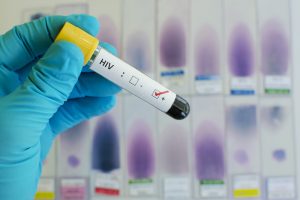 5 things you may not know about HIV