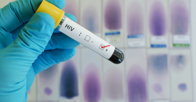 things you may not know about HIV