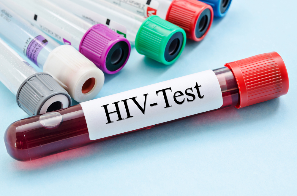 5 things you may not know about HIV