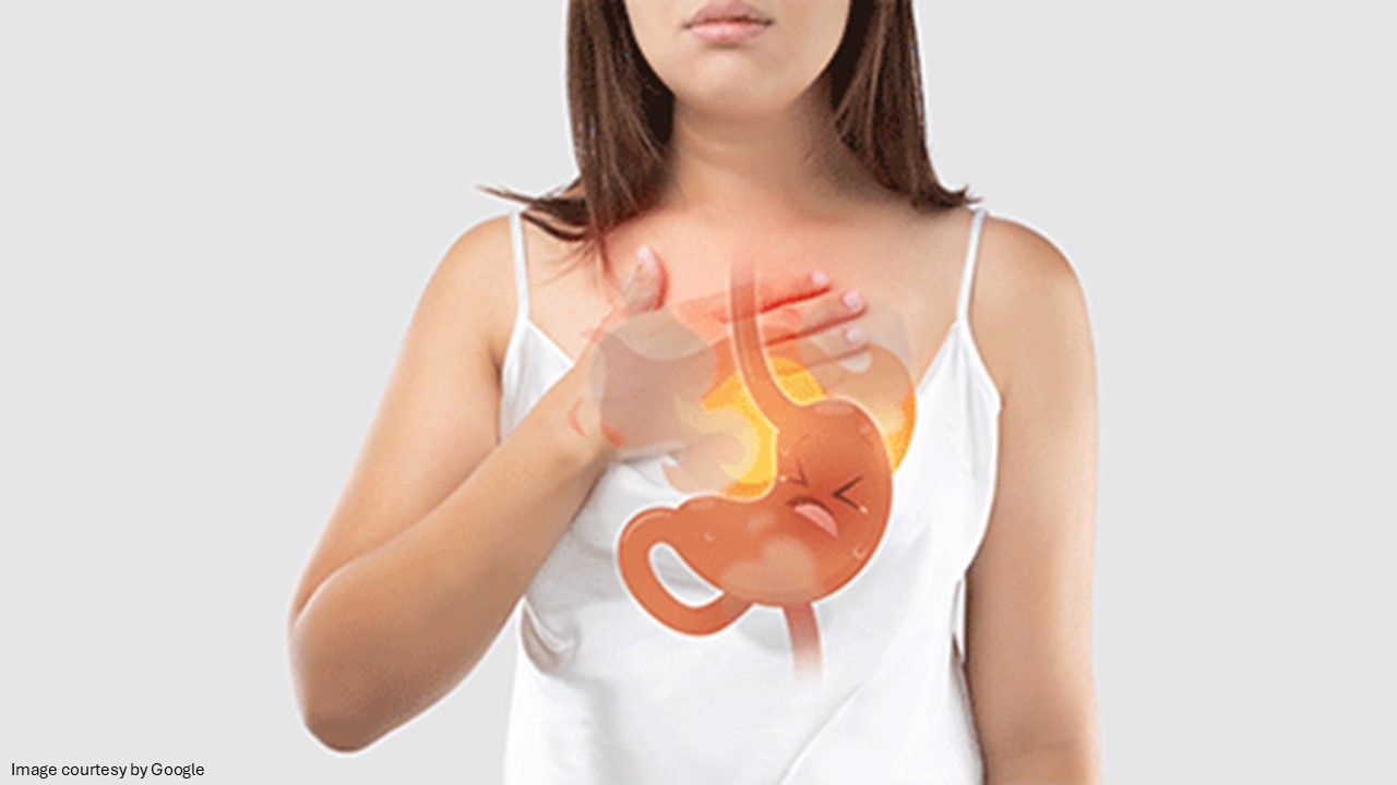 acid reflux remedies​ - ADC