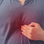 7 Ways to Treat Acid Reflux