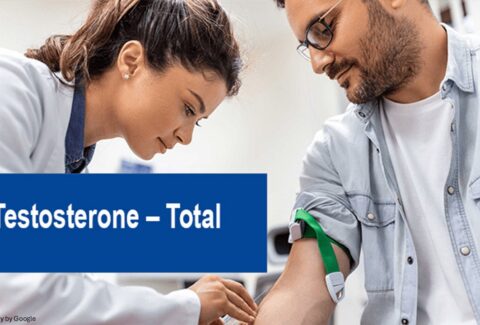 test for low testosterone - ADC