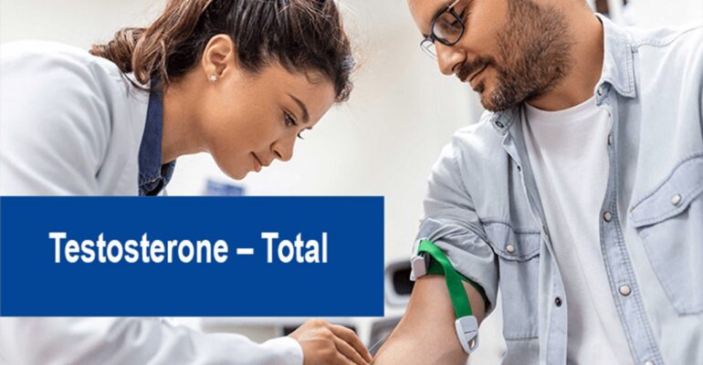 test for low testosterone - ADC