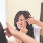 Ways to deal with Hormonal Acne during periods