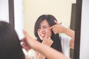 Ways to deal with Hormonal Acne during periods