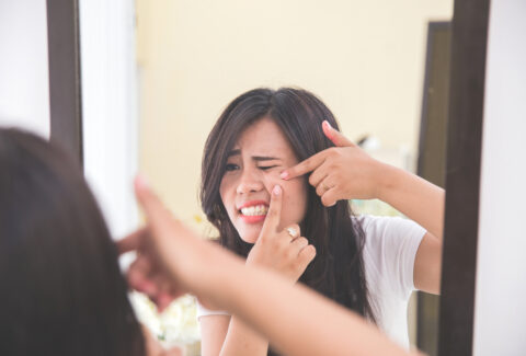Ways to deal with Hormonal Acne during periods