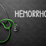 All about Hemorrhoids